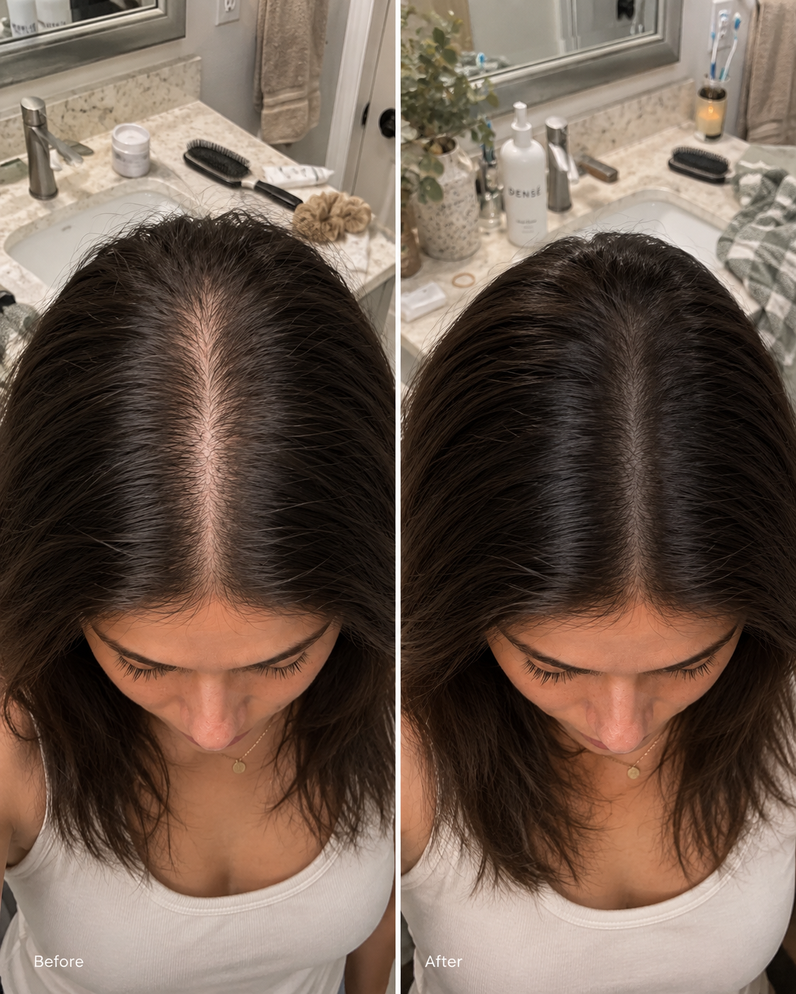 Before and after using Densé