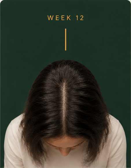Week 12 scalp comparison with Densé